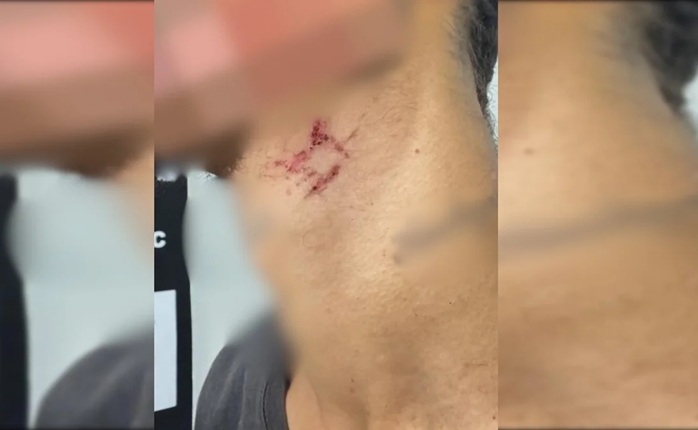 Gay era mantido como escravo sexual em Goiânia