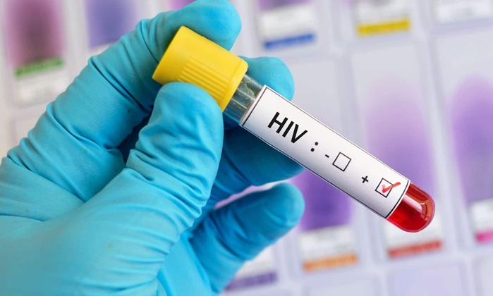 Médico revela que ex-namorado tentou lhe passar HIV