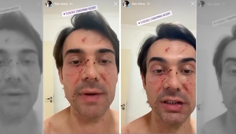 Jefferson Schiavone: cabeleireiro hétero sofre agressão homofóbica junto com amigo gay em Ribeirão Preto (SP)