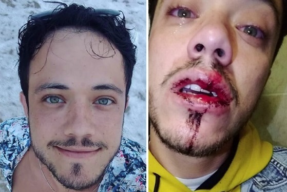 Brasileiro é espancado na Irlanda após beijar namorado